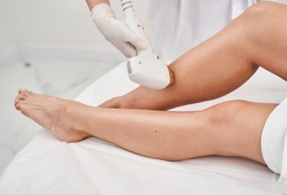 Laser Hair Removal