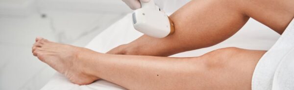 Laser Hair Removal