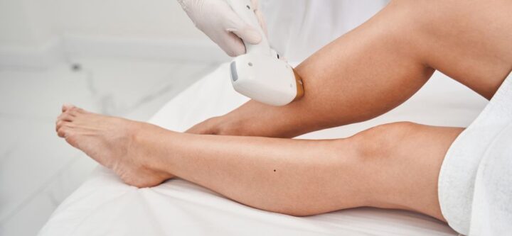 Laser Hair Removal