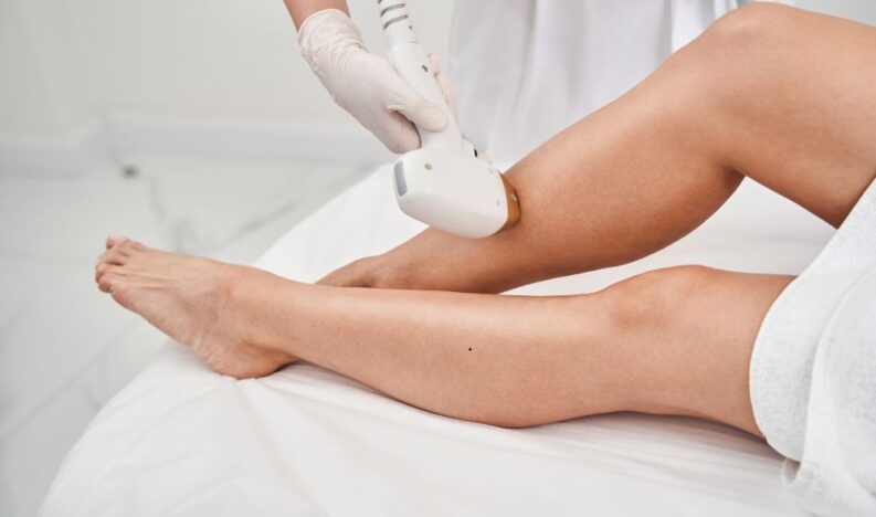 Laser Hair Removal