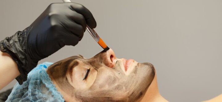 Carbon Facial